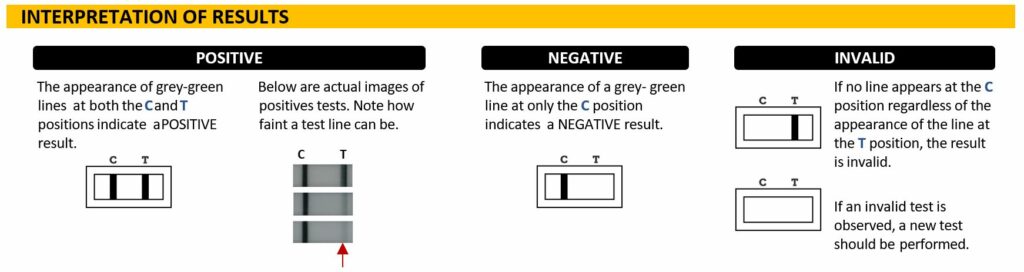 ACUVID Interpretation Results